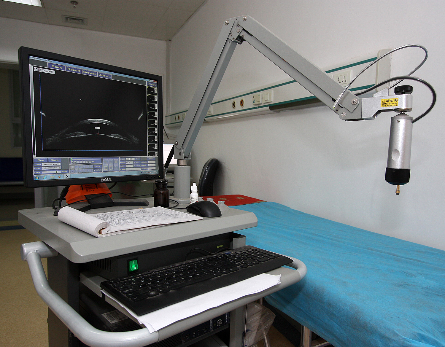 超声生物显微镜（UBM）