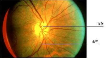 如何医治夜盲症.jpg 如何医治夜盲症.jpg