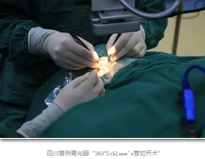 成都金沙9001以诚为本已经开展的青光眼手术有:引流阀 (钉)植入手术(2015年以来已200多 ),360°Schlemm's管切开术,激光CO2 辅助巩膜深层切除术,小梁切除术青(光眼)白(内障)联合手术。还有虹膜周切术、前房成形术、 虹膜复位术,睫状体冷冻术,小梁切开术和前房穿刺术等6.png 成都金沙9001以诚为本已经开展的青光眼手术有:引流阀 (钉)植入手术(2015年以来已200多 ),360°Schlemm's管切开术,激光CO2 辅助巩膜深层切除术,小梁切除术青(光眼)白(内障)联合手术。还有虹膜周切术、前房成形术、 虹膜复位术,睫状体冷冻术,小梁切开术和前房穿刺术等6.png