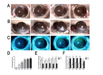 干眼症医治.jpg 干眼症医治.jpg