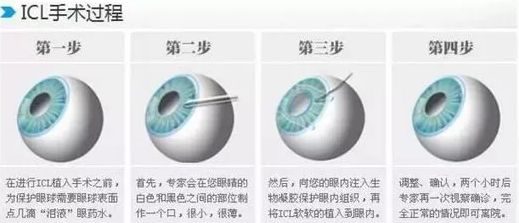 全国高考成绩分数线陆续出来了安徽理工大学附属眼科医院近视手术医生温馨提醒近视考生要注意这些3.png 全国高考成绩分数线陆续出来了安徽理工大学附属眼科医院近视手术医生温馨提醒近视考生要注意这些3.png