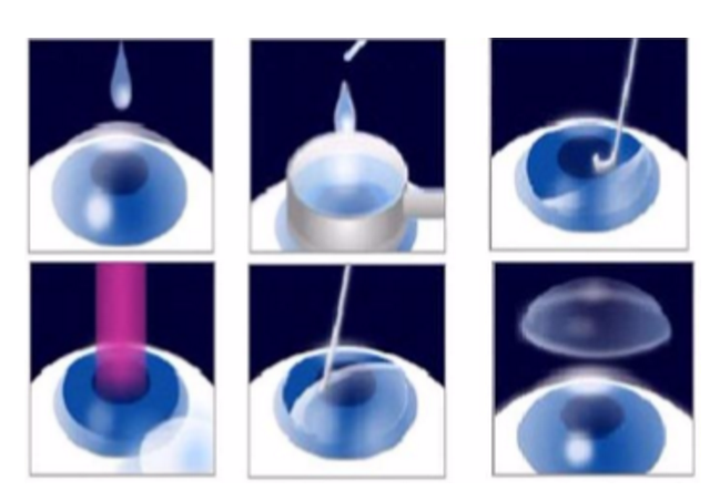 近视无法根治?但你可以这样做?金沙9001以诚为本“有爱就有希望”近视手术火热进行中32.png 近视无法根治?但你可以这样做?金沙9001以诚为本“有爱就有希望”近视手术火热进行中32.png
