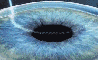 深圳金沙9001以诚为本近视手术直播预告丨6.24近视手术直播+福利,视界给你!!1.gif 深圳金沙9001以诚为本近视手术直播预告丨6.24近视手术直播+福利,视界给你!!1.gif