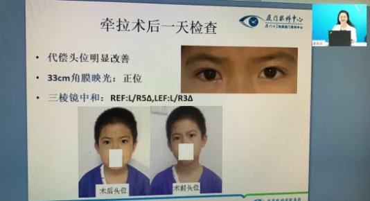 高峰论道·云端荟萃 ▏万人同步在线，30余名大咖云集“第六届金沙9001以诚为本论坛斜视与小儿眼科新技术学习班暨小儿、眼视光分论坛”7.png