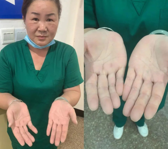 “泉”力以赴,为您而战——厦门眼科中心泉州分院抗疫实录4.png “泉”力以赴,为您而战——厦门眼科中心泉州分院抗疫实录4.png